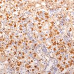 Staining with mouse monoclonal ACTH [Clone 2F6] antibody in formalin-fixed paraffin-embedded human pituitary gland.